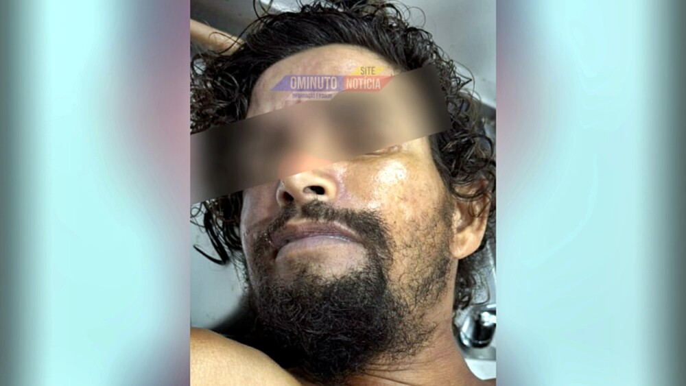 Autoridades liberam divulgação de foto de vítima morta atropelada na RO-383, no sábado a noite, em Cacoal, RO