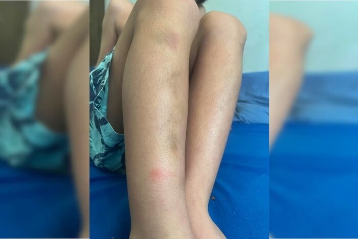 Filho de publicitário preso e agredido por agentes ficou com hematomas