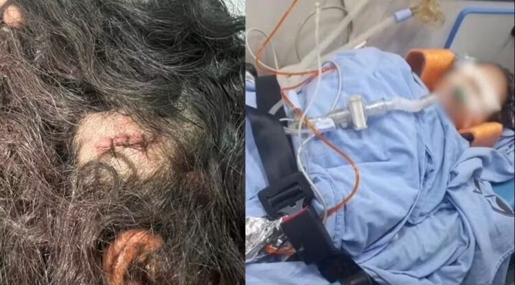 Homem é preso suspeito de tentar matar enteado de 3 anos, em Buritis, RO