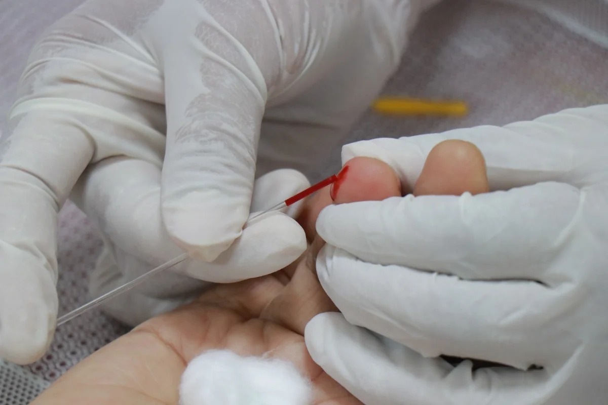 Endocrinologista explica como reconhecer sinais precoces da diabetes