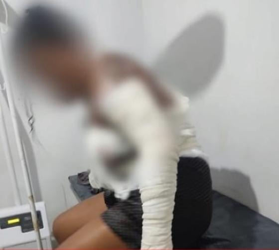 Homem é preso por tentar matar esposa com fogo em Mato Grosso