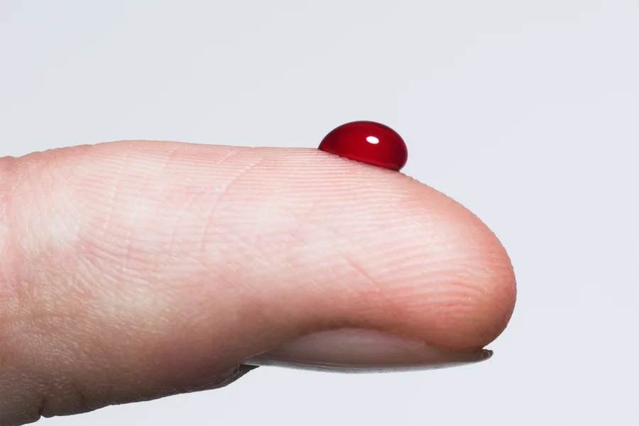 Picos de glicose em pessoas com diabetes aumentam risco de Alzheimer