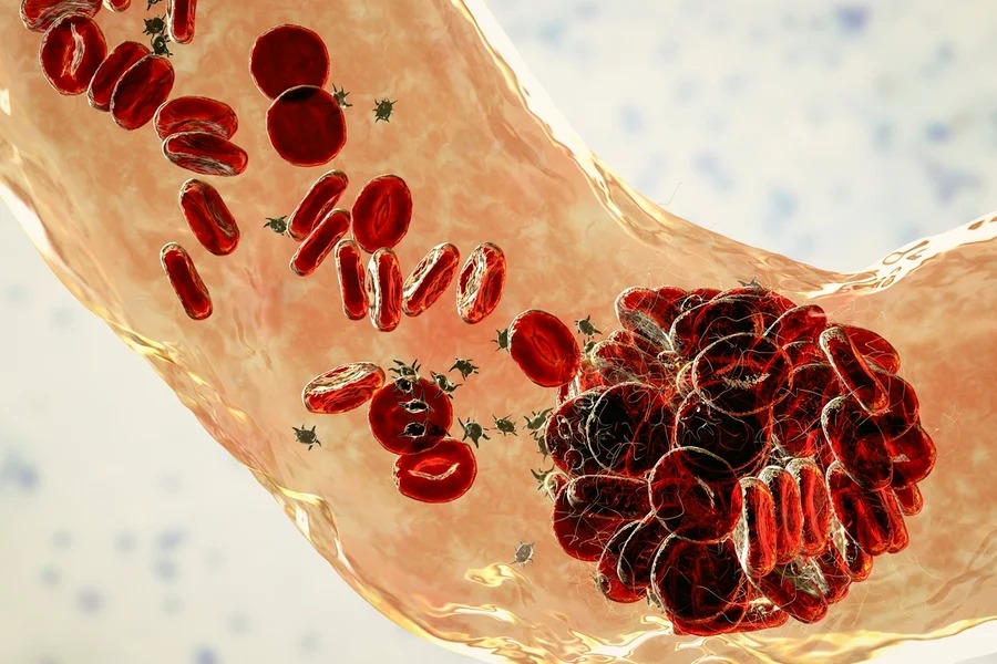 Novo método usa sangue menstrual para detectar câncer