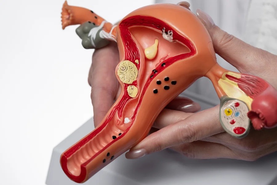 Prevenção e detecção precoce salvam vidas