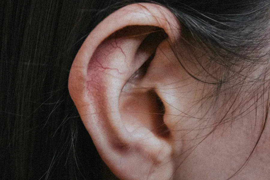 Correção de orelha mal formada traz benefícios