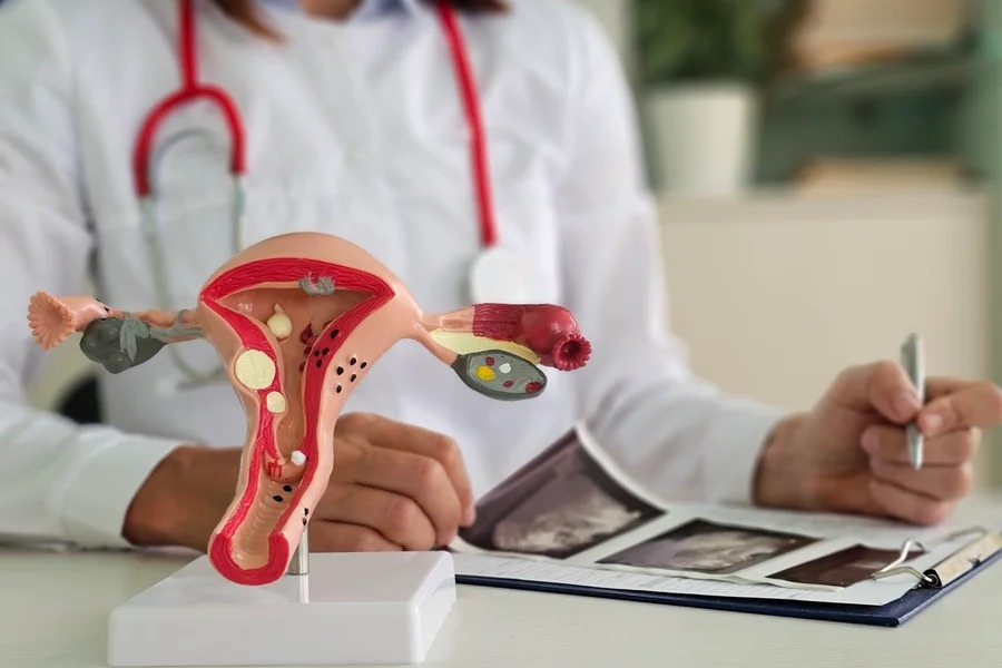 Importância do ginecologista além do sistema reprodutor