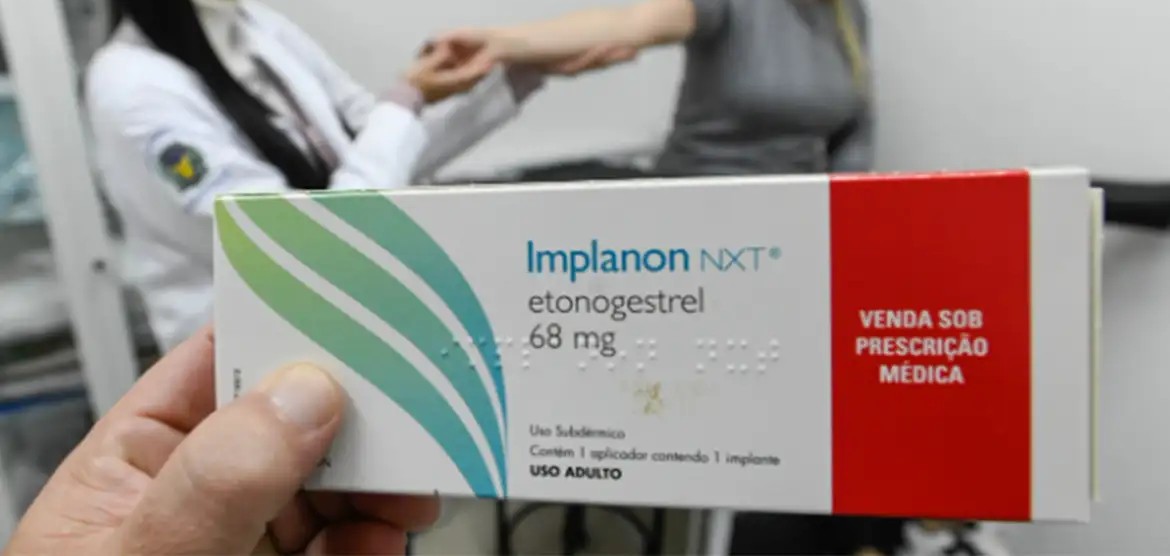 Alex Redano solicita 350 implantes contraceptivos para mulheres de Alvorada