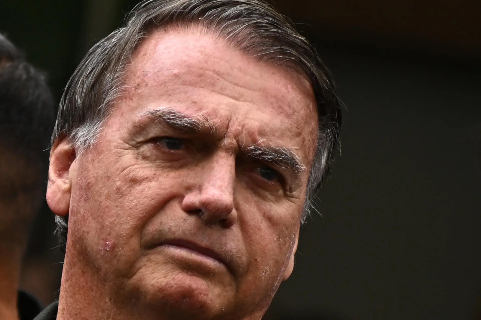 Moraes libera procedimento e Bolsonaro será operado nesta sexta-feira