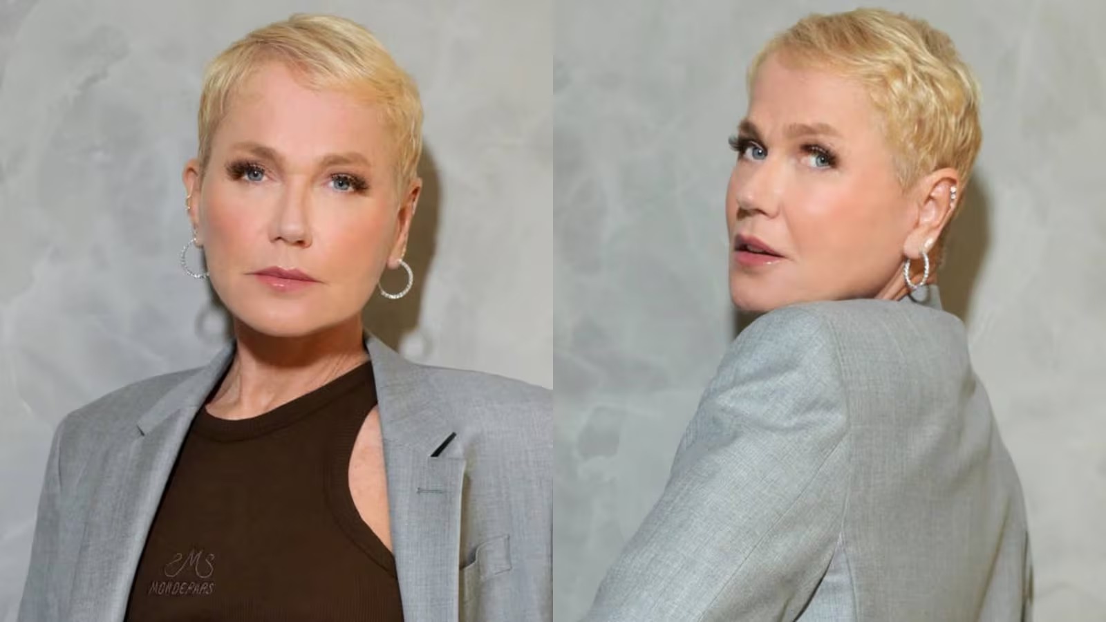 Após transplante capilar, Xuxa abre o jogo sobre a alopecia