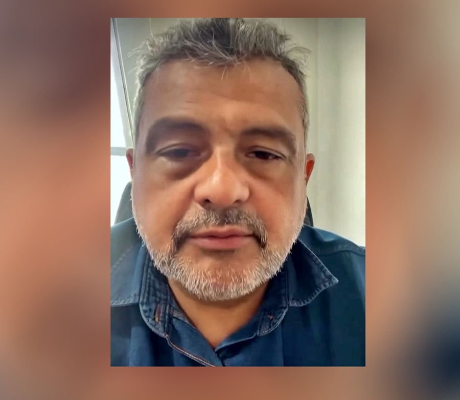 Jabá Moreira busca holofotes no voto de Rafael É O Fera!
