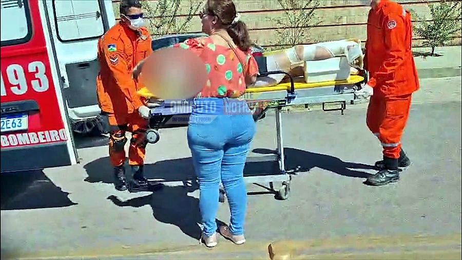 Moto de aplicativo empina em ladeira e passageira sofre fratura exposta