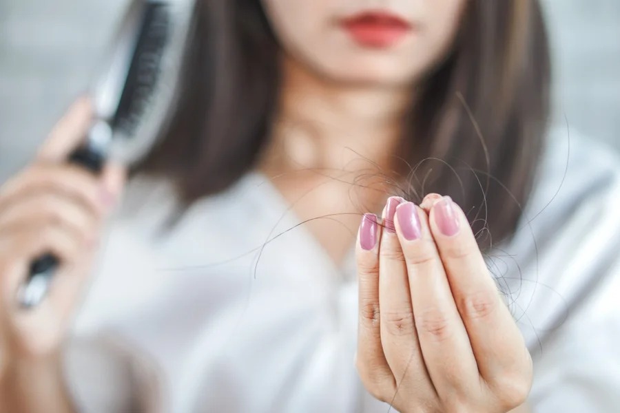 Entenda a relação entre anticoncepcionais e queda de cabelo