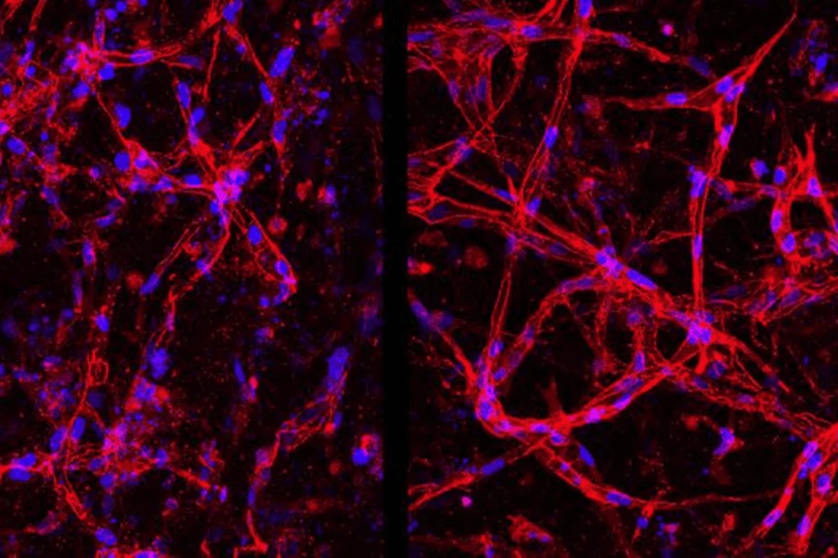 Tecnologia permite criação de células da retina para tratar cegueira