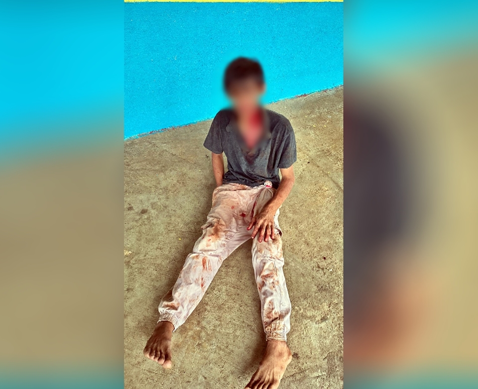 Homem é agredido com pedaço de madeira por faccionados, em Cacoal, RO