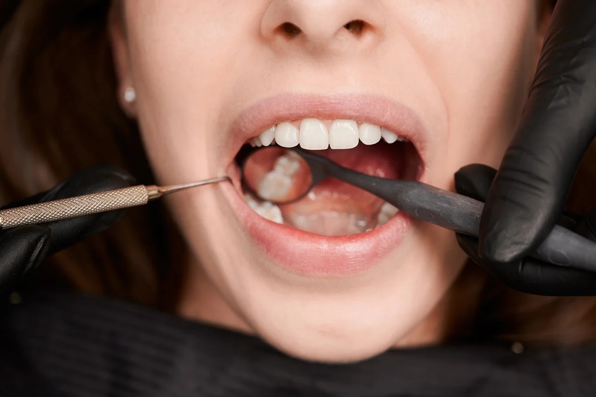 Cientistas testam tecnologia que promete regenerar dentes danificados
