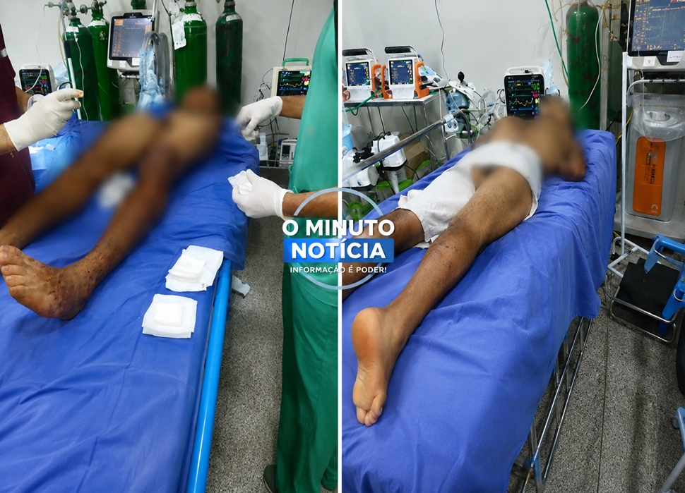 Jovens ficam feridos após ataque com faca em Espigão do Oeste, RO