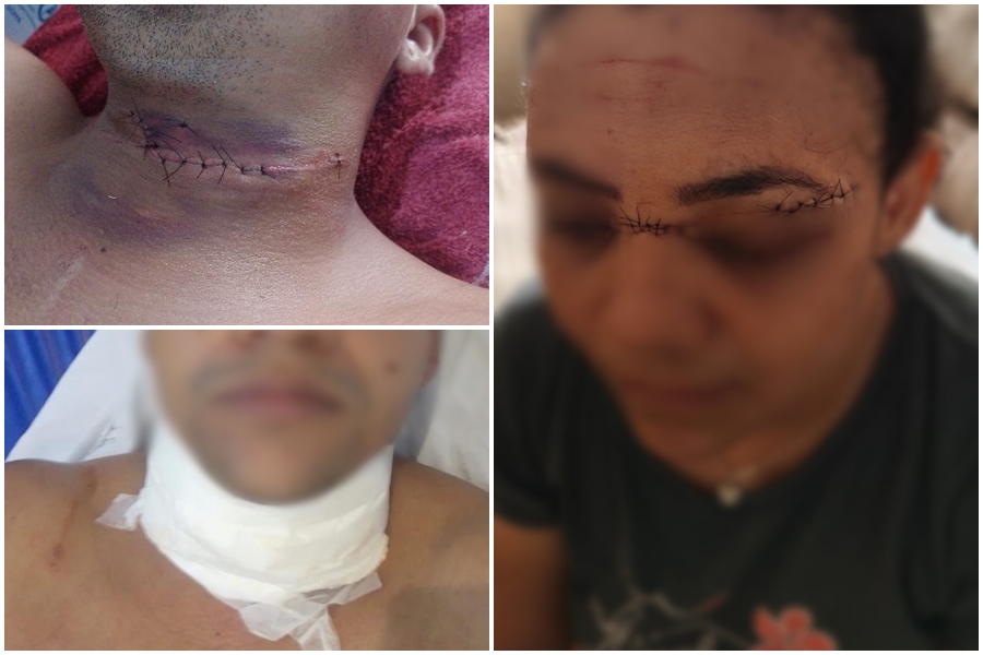 Linha de cerol deixa duas pessoas feridas em Cacoal e acende alerta sobre lei em Rondônia