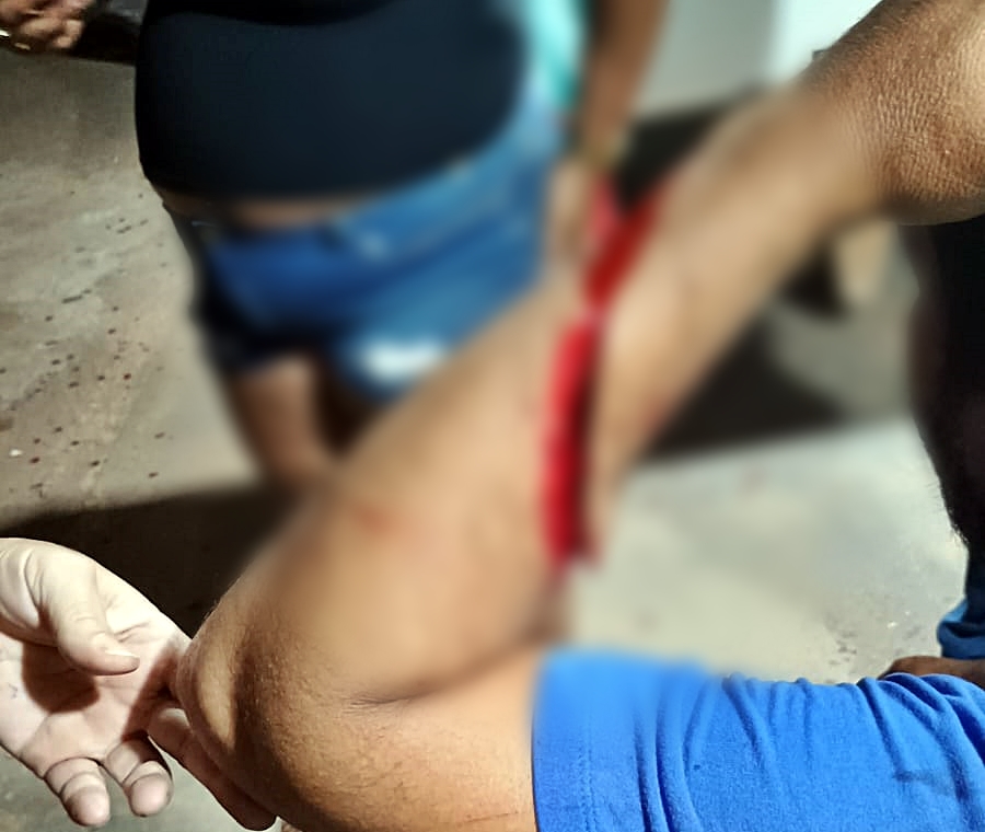 Homem é ferido com golpes de facão no bairro Teixeirão