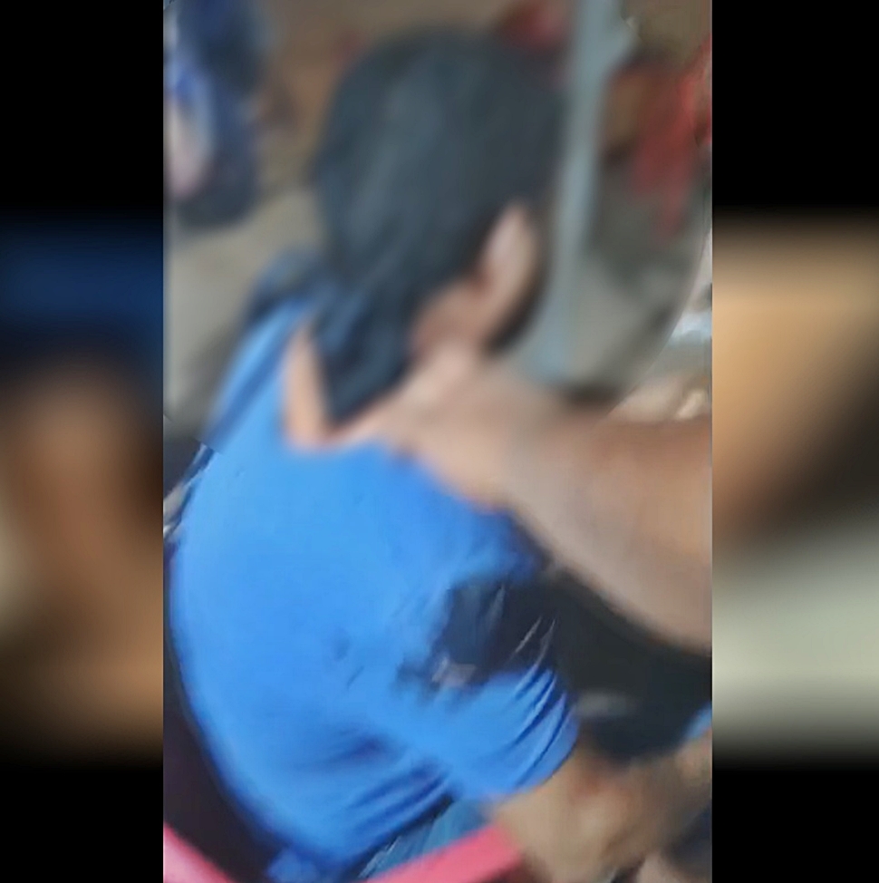 Homem ferido no Teixeirão foi atacado com canivete, em Cacoal, RO; informação inicial era de que foi facão!