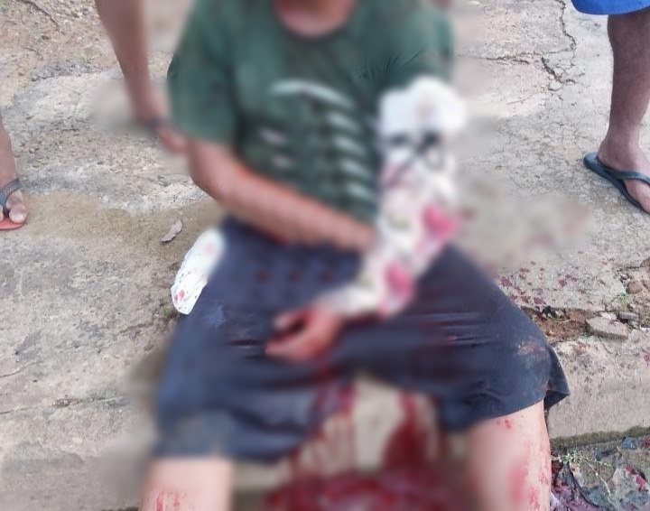 Irmão entram em confronto armados com facão e um deles vai parar no hospital, em Ji-Paraná-RO