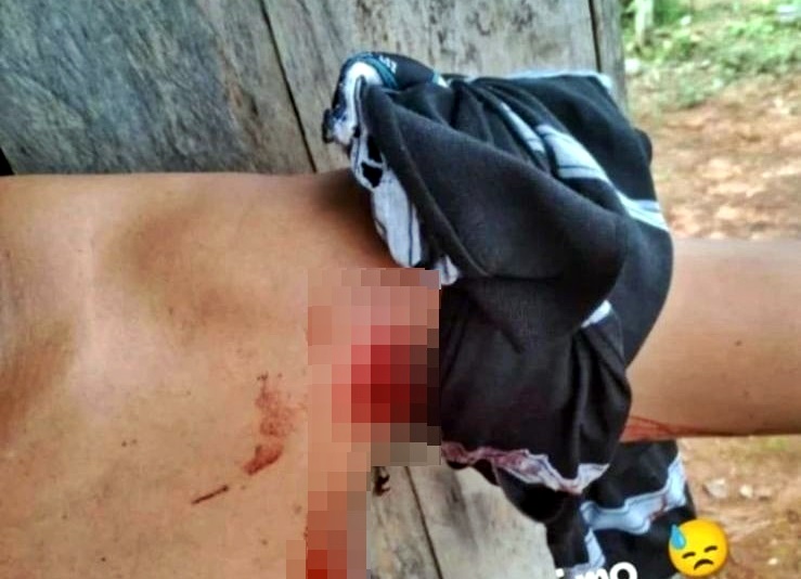 Parentes confirmam que homem esfaqueado na Linha 617, em Jorge Teixeira está se recuperando