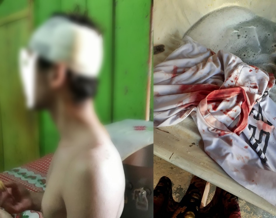 Jovem é espancado em frente ao Las Vegas e tem cabeça lesionada por garrafadas, enquanto seguia para trabalhar de madrugada