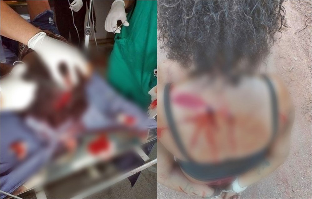 Mulheres brigam com facas e tesoura na Rua da Matriz em Espigão do Oeste; socorridas e detidas