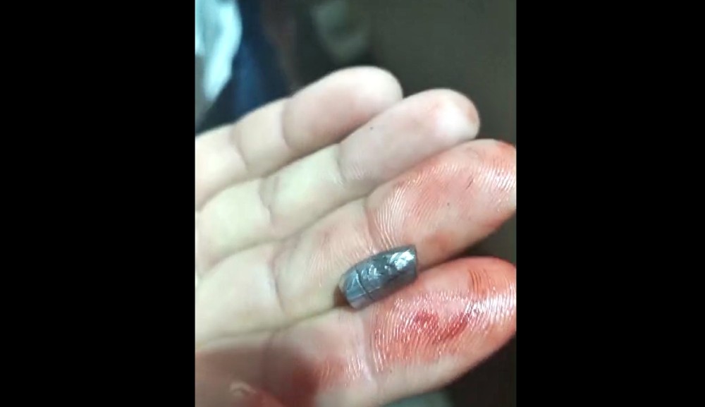 Mulher é baleada em tentativa de assalto no Greenvile em Cacoal, RO