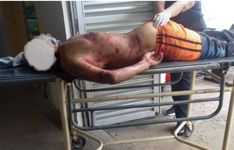 Bandido temido na região de Buritis é morto em confronto com a polícia