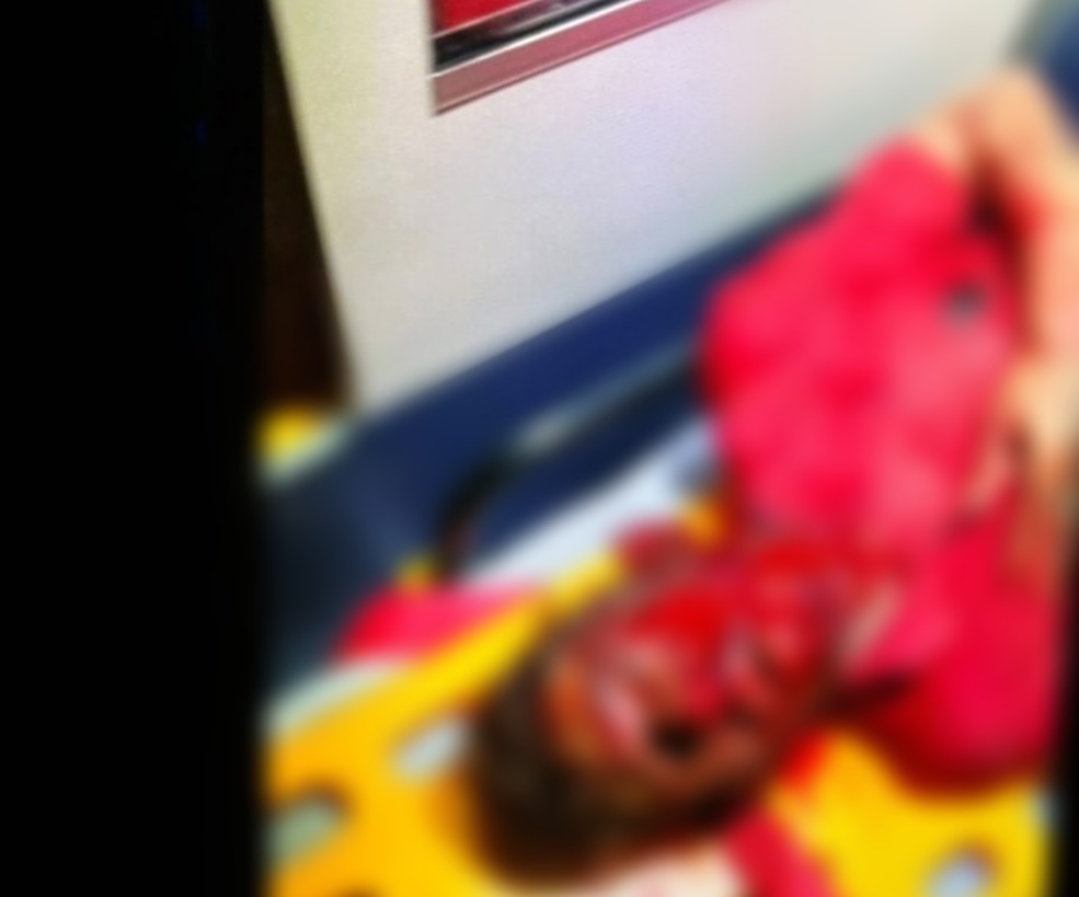 Imagem 2