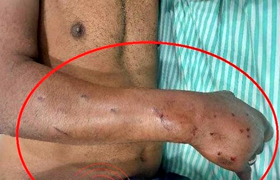 Homem é socorrido ao hospital após ser baleado em Vilhena, RO