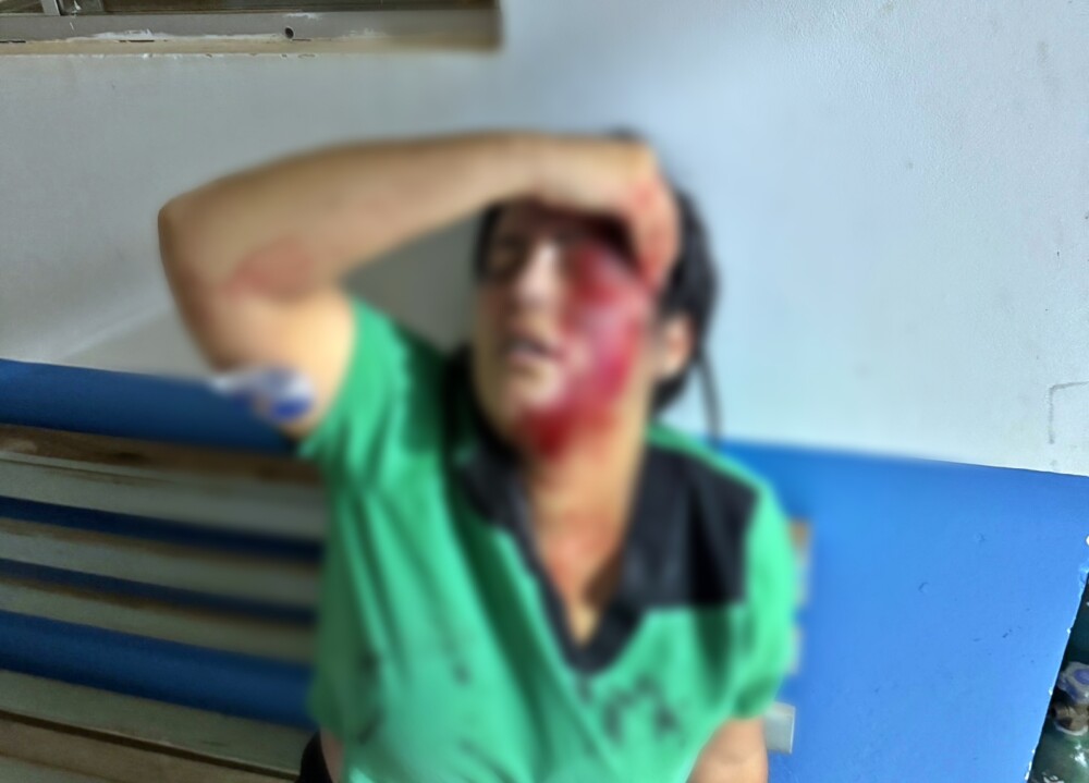 Candidata a prefeita em Primavera de RO, é atacada a pedradas e apoiadora foi atingida na cabeça