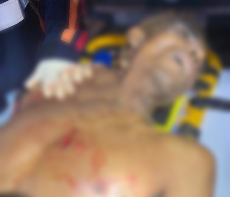 Homem de 39 anos é morto a facadas no bairro Riachuelo em Ji-Paraná